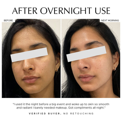 Bio-Collagen Real Deep Mask | Korean Hydrogel Sheet Mask | Pack of 4